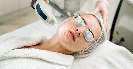 does insurance cover laser acne scar removal