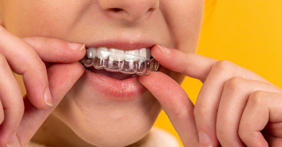 what insurance covers invisalign