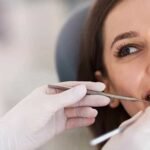 how to get veneers covered by insurance